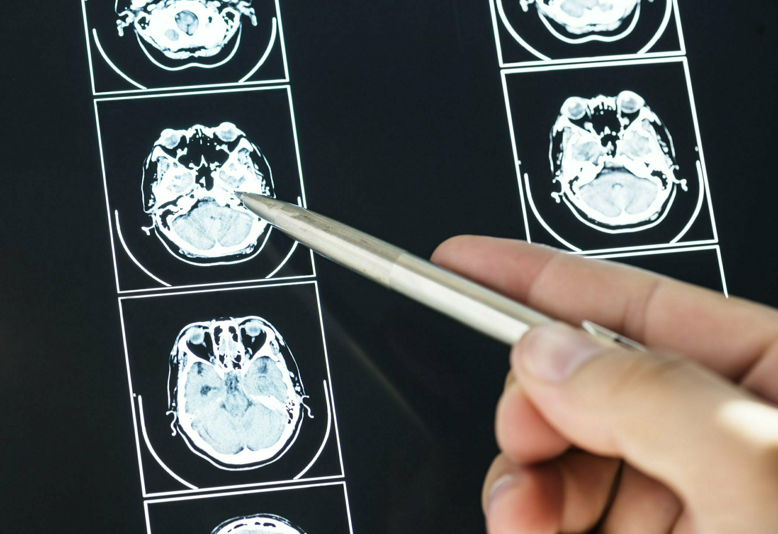 DOCTOR REVIEWING MRI